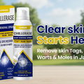 Timilk® ChillErase Bump Renewal Spray
